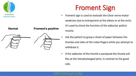 Froment Sign