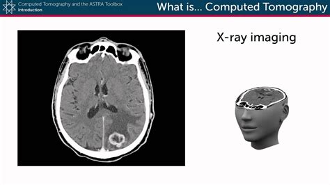 What is Computed Tomography? - YouTube