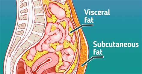 What Visceral and Subcutaneous Fat Are, and Which of Them Is Bad for ...