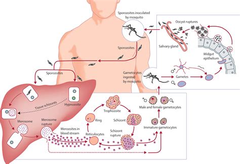 Key gaps in the knowledge of Plasmodium vivax, a neglected human ...