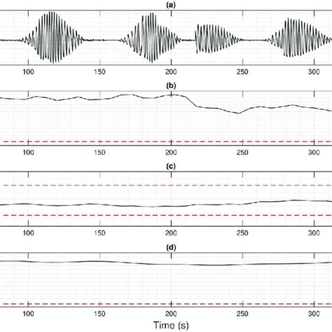 Patient with periodic breathing preceding Cheyne-Stokes respiration (a ...