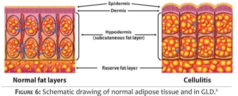 [PDF] Hypodermis and subcutaneous adipose tissue ­ two different ...