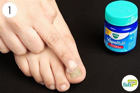 Redirecting | Vicks for toenail fungus, Toenail fungus remedies ...