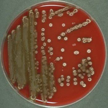 Bacillus subtilis