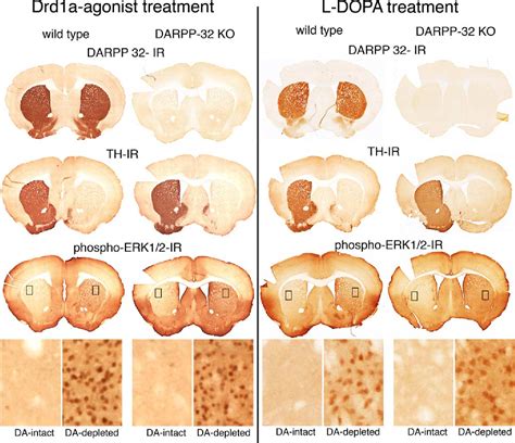 Figure 4 from Differences between Dorsal and Ventral Striatum in Drd1a ...