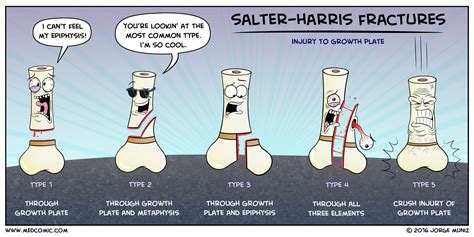 For Comic Lovers, Fun Way To Study: Salter-Harris Fractures Remix ...