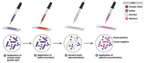 Gram Staining | Principle | Procedure and Results