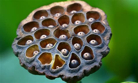 Trypophobia Skin Causes