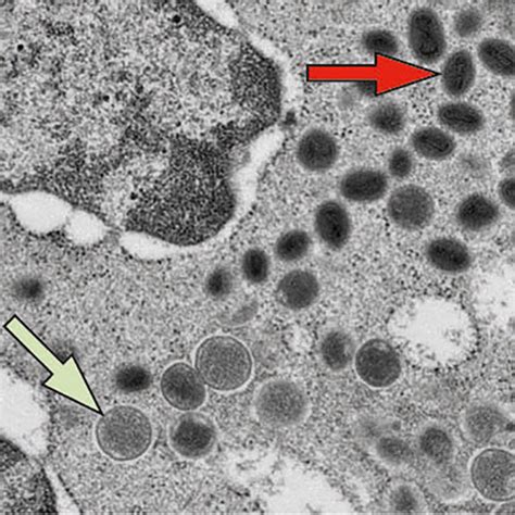 Virus Under Electron Microscope