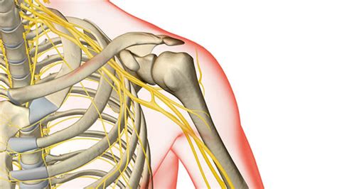 Brachial Plexus Injury Adult