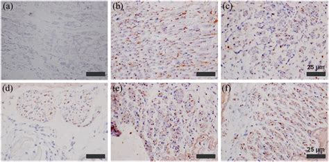 Immunostaining for neurofilaments in the implanted conduits. Anti-NF ...