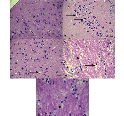 Neuronal morphology indicated by hematoxylin-eosin staining. A ...