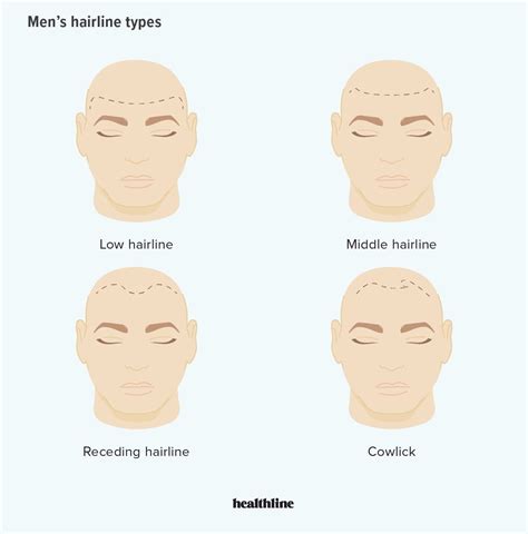 Hairline Types For Men and Women, Plus How to Change Your Type | Men ...