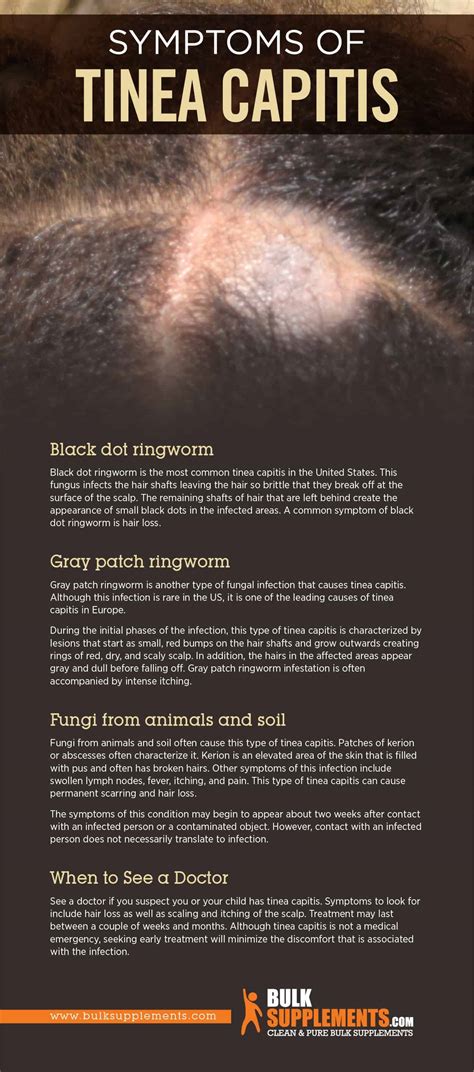 Do Bald Spots From Ringworm Grow Back - Printable Form, Templates and ...