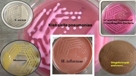 Enterobacter Aerogenes Morphology