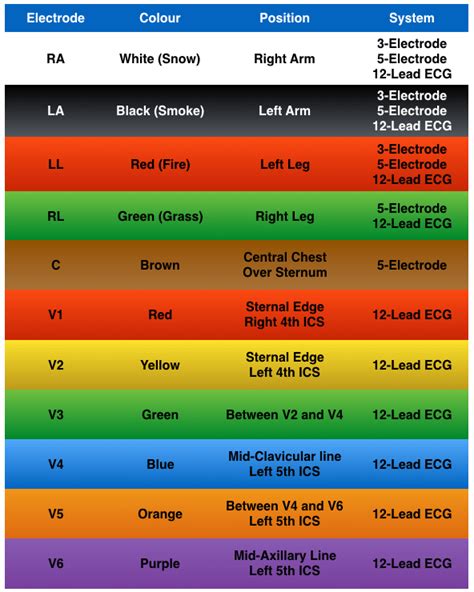 ECG Lead positioning • LITFL • ECG Library Basics