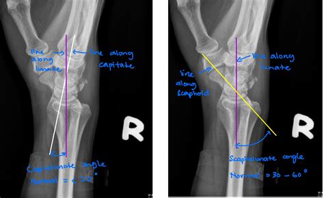 Quiz 36 MSK – Radiology Cases