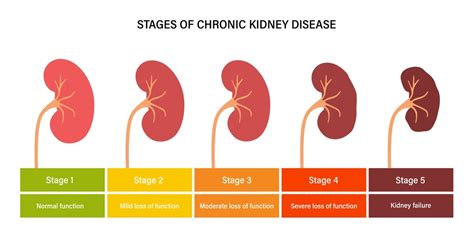 Chronic Kidney Disease – Causes, Symptoms, Treatments