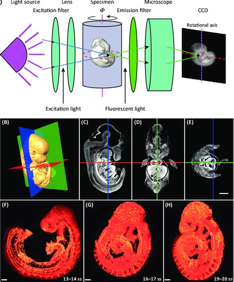 Optical projection tomography schematic and examples of... | Download ...