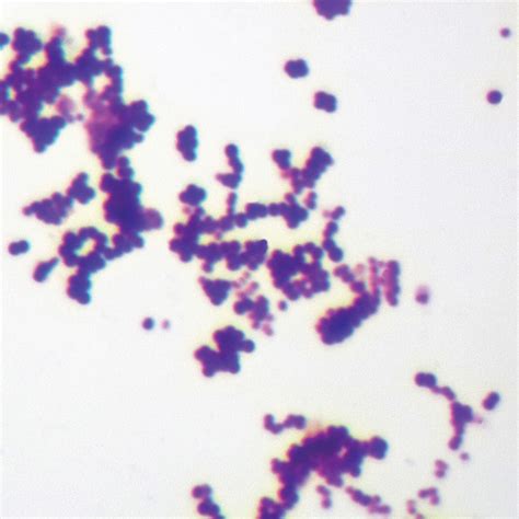 Mixed Gram-Positive & Gram-Negative Coccus, w.m. Gram Stain Microscope ...