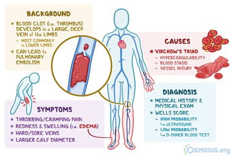 Venous Thrombosis Treatment