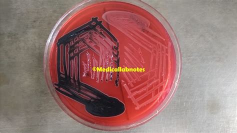 XLD Agar: Introduction, Composition, Principle, Preparation, Test