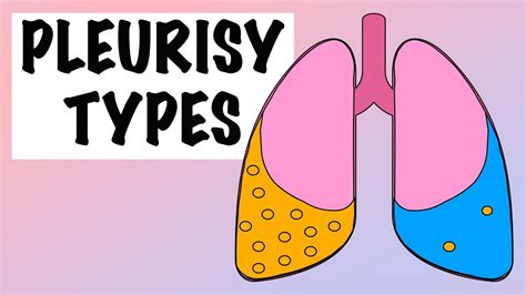 DIFFERENCES BETWEEN EXUDATIVE AND TRANSUDATIVE PLEURAL EFFUSION - YouTube