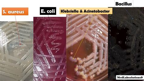 Escherichia Coli Colony Morphology