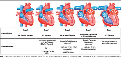 Aortic Stenosis Stages