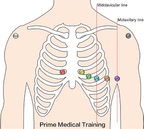 The Ultimate 12-Lead ECG Placement Guide (With Illustrations)