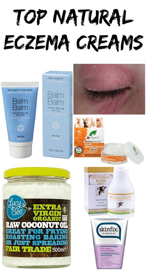 Top 5 Natural Eczema Creams For Sensitive Skin. | LUX LIFE LONDON | A ...