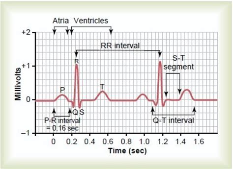 Ekg Interpretation How To Read An Electrocardiogram Ecg | Images and ...