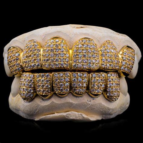 Buy Iced Diamond Grillz for Teeth Online - ON SALE Today! - Custom Gold ...