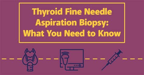 Thyroid Fine Needle Aspiration Biopsy: What You Need to Know | UVA ...