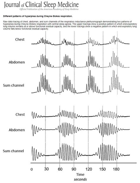 Two Distinct Patterns of Hyperpnea During Cheyne-Stokes Respiration ...