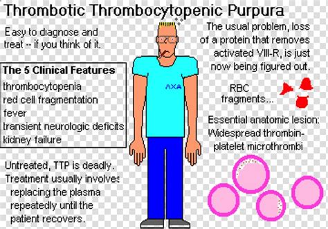 Thrombotic thrombocytopenic purpura, what to know?