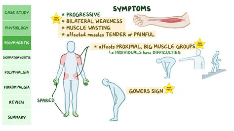 Myalgias and myositis: Pathology review: Video | Osmosis