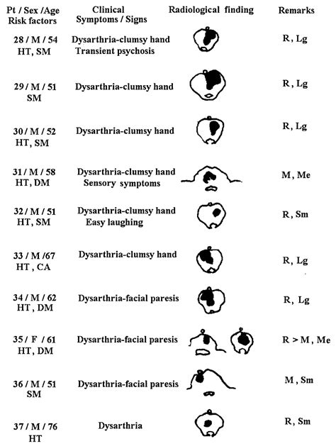 Medial Pontine Syndrome