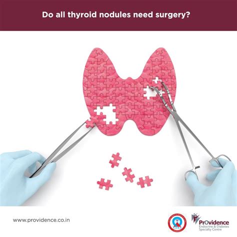 Do All Thyroid Nodules Need Surgery? | Thyroid Nodule Removal Surgery