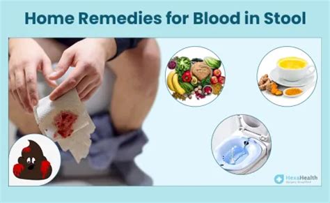 10 Best Home Remedies for Blood in Stool in India