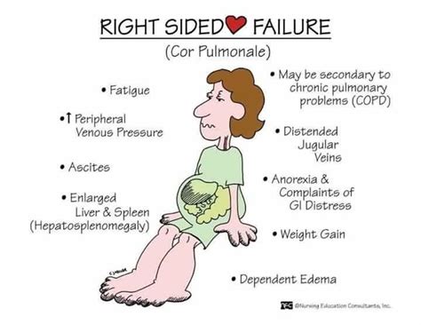 Pin by Melissa Wirz on Nursing | Nursing mnemonics, Nursing students ...