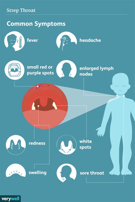 Strep Throat: Signs, Symptoms, and Complications