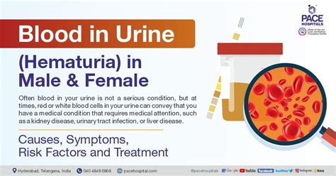 Blood in urine (Hematuria) - Causes, Symptoms and Treatment