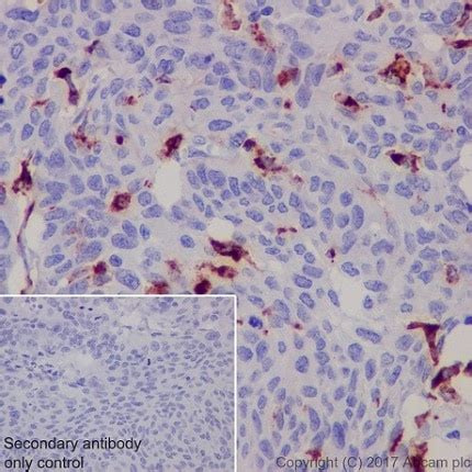 Microglia markers | Abcam