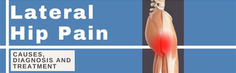 Lateral Hip Pain: Causes, diagnosis and treatment | Find out more