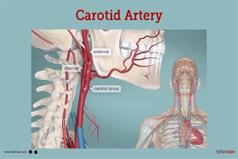 Real Human Arteries