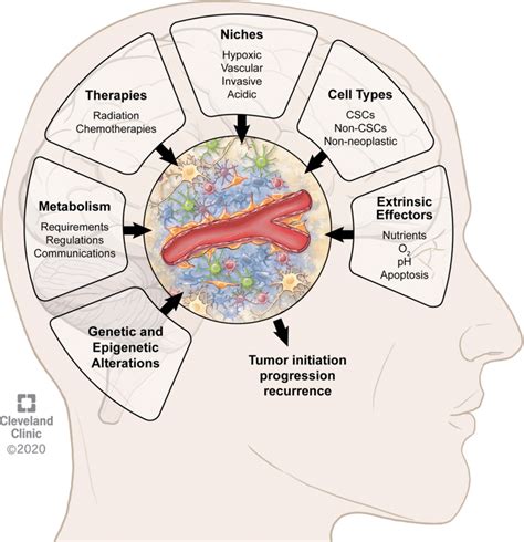 Features of the tumor microenvironment in glioblastoma contributing to ...