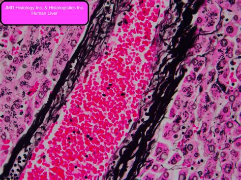 JMDHistology.com The Reticulum Stain is used in the histological ...