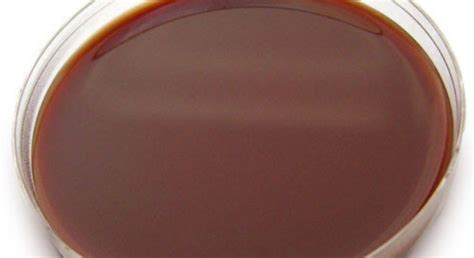 chocolate agar | Ask Microbiology