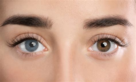 How to Change Eye Color Naturally? Is it Even Possible? - Healthwire